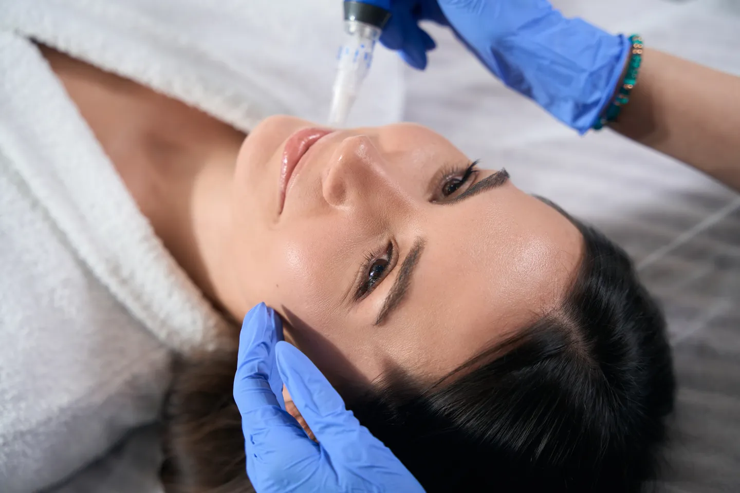 Microneedling treatment at NorCal Plastic Surgery in the San Francisco Bay Area