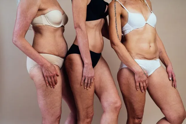 Planning Your Body Contouring Surgery Around the Holidays: Timing & Recovery Tips at NorCal Plastic Surgery