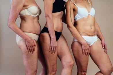 Body contouring surgery holidays norcal plastic surgery sf bay area