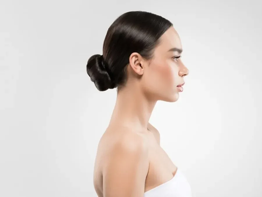 Candidate neck lift norcal plastic surgery sf bay area