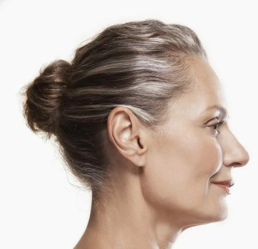 Ear surgery otoplasty norcal plastic surgery sf bay area