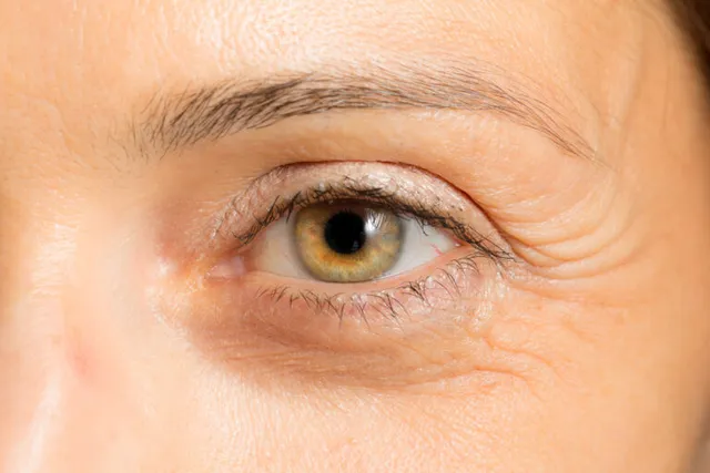 How Much Does an Eyelid Lift Cost? at NorCal Plastic Surgery