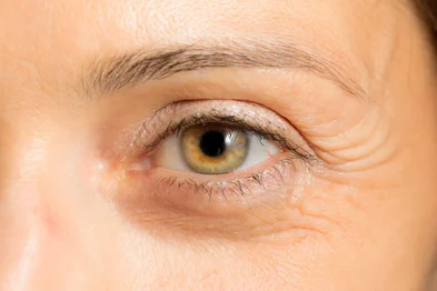 Eyelid lift cost norcal plastic surgery sf bay area