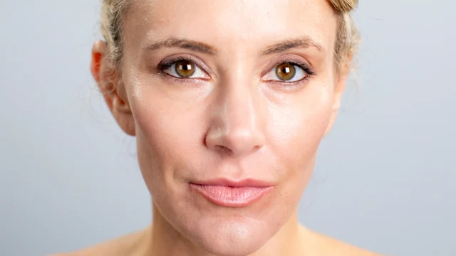 Norcal plastic surgery service rhinoplasty