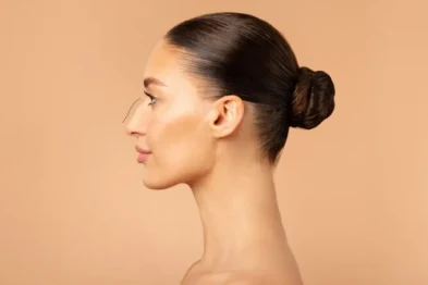 What to expect after rhinoplasty norcal plastic surgery sf bay area