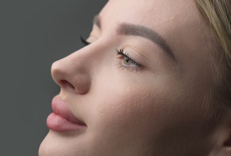 How Long is Recovery After Rhinoplasty?